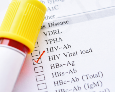 AUMENTAN LOS CASOS DE VIH EN HONDURAS